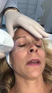 Wist je dat Tixel ook fijne rimpeltjes...