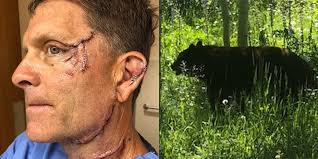 This Man Nearly Lost His Eye After a Black Bear Attacked Him in His Home