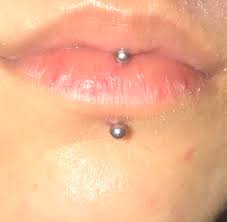 Lip Vertical Labret Piercing Bump Not Going Away Piercing