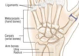 To know if you have sprained your wrist, is, discoloration, swelling, and if you write that should hurt too. Wrist Sprain Guide Causes Symptoms And Treatment Options