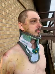 No. 24-1367 IN THE UNITED STATES COURT OF APPEALS FOR THE TENTH CIRCUIT  ZACH PACKARD, ET AL. Plaintiffs-Appellees, v. CITY AND