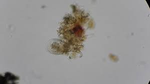 Animal cell under microscope 40x. Pond Water Under Microscope 200x Stock Footage Video 100 Royalty Free 11555810 Shutterstock