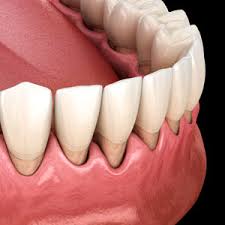 Don T Delay Seeing The Dentist If You Suspect Gum Recession John L Hyatt Dds Ms Pa