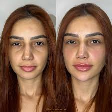 Maria Eduarda Moura (@dradudamoura) • Instagram photos and videos