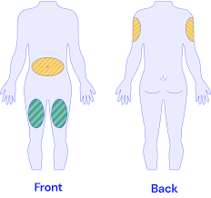 Image result for Subcutaneous Injection