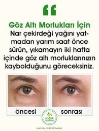 Pin By Emine Sultan On Guzel Face Mapping Acne Face Care Face Acne