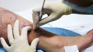 Tattoos and scarification are both types of body modifications. Scarification As Part Of Body Stock Footage Video 100 Royalty Free 26295044 Shutterstock