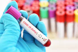 Whereas the loss of taste and smell was among the most telltale signs of the coronavirus throughout the pandemic, many getting sick with the delta variant present with more vague symptoms that may. Health Experts Say Delta Variant Symptoms Are Different Than Common Covid 19 Symptoms Here S What To Look Out For 8news