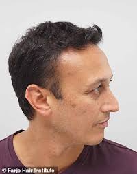 Other character tags to be added. Emmerdale Star Chris Bisson Zeigt Dramatischen Wandel Wie Er Eine Haartransplantation Aktuelle Boulevard Nachrichten Und Fotogalerien Zu Stars Sternchen
