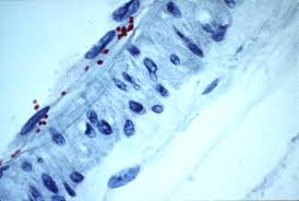 Image result for Rickettsiae