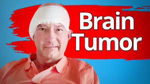 Could Keto Have Prevented His Brain Tumor?