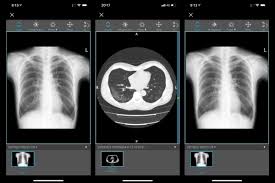 Nosso sistema acaba com a necessidade de gravações em dvd, o que minimiza erros de gravação e libera a sala para um novo exame imediatamente, aumentando a produtividade e rentabilidade da clínica. Grupo Fleury Ajuda Hospitais Publicos A Analisar Exames De Imagem Com Suspeita De Covid 19 Setor Saude