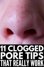 How To Get Rid Of Clogged Pores 11 Remedies Products We Swear By In 2020 Clogged Pores On Nose Nose Pores Clear Clogged Pores