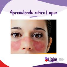 El artista Ariel Ocampo realizó una pintura en vivo acompañando las  actividades y buscando a través del arte, visibilizar y sensibilizar sobre  las EPOF, reflejando la diversidad, la esperanza y la lucha