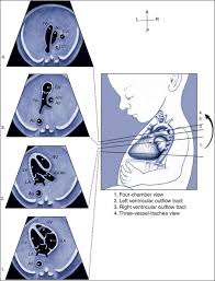 Guidelines For The Performance Of The Sonographic Screening And Echocardiography Examination Of The Fetal Heart Obgyn Key