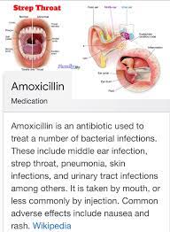 Common symptoms of colds and strep throat are a sore throat and fever, but if you have a cold the pain in your throat will be the same all the time, while strep throat pain increases when swallowing. Medicine Indication Medical Knowledge Amoxicillin Medical School Studying