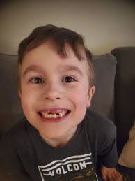 Shilo Hill Loses Tooth Eating Pizza