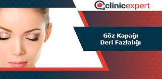 Goz Kapagi Deri Fazlaligi Clinicexpert Uluslararasi Saglik Hizmetleri