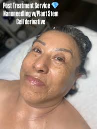 Here are 5 Mewing exercises to snatch the jawline. 💋