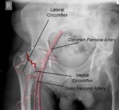 He found the interosseous membrane intact in the cases he was able to create. Femoral Neck Fractures Trauma Orthobullets