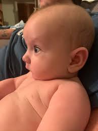 My baby is home! He is very tired and has a lot of recovery ahead of him.  In 10 days he can have his staples removed. 💙