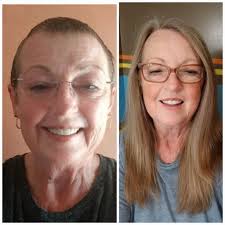 Over 4 years dye free hair. I love the freedom and my natural curls are so  more manageable. Happy silver hair everyone 🤗❤️❤️