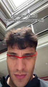 #inclinacioncantal #pipipi