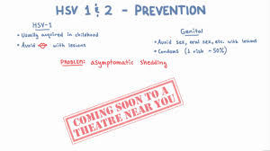 So if you were just how do you contract hsv 1? Hsv 1 And 2 Prevention Youtube