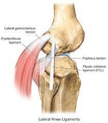 The fibular collateral ligament is one of the ligaments that make up the knee joint. Lcl Injury Of The Knee Knee Sports Orthobullets