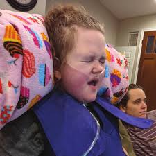 Rett Syndrome Externally-Led Patient-Focused Drug Development Meeting