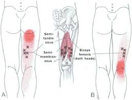 Biceps femoris tendinopathy anatomy there are two heads of origin in the joint. Biceps Femoris Physiopedia