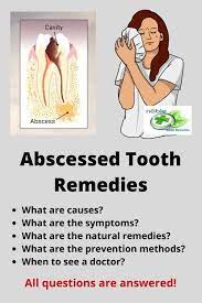 Best Natural Antibiotics Tooth Abscess Symptoms And Treatments In 2021 Teeth Remedies Abscess Tooth Tooth Infection