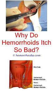 4 Mind Blowing Diy Ideas What Do You Get For Hemorrhoids How Painful Can Hemorrhoids Get What Do You Get For Hemorrhoids Can A Bleeding Hemorrhoids Hemorrhoids Treatment Cure For Hemorrhoids