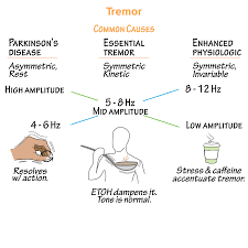 Image result for Essential Tremor