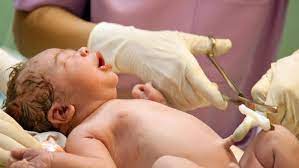 New Recommendations Suggest Waiting Up To 1 Minute Before Cutting Umbilical Cord Ctv News