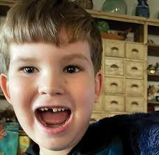 All I want for Christmas is my two front teeth