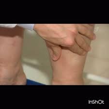 Când creierul primește semnale că plămânii se umplu cu apă, trimite comenzi pentru a reduce ritmul cardiac și pentru a redirecționa sângele de la extremități către. Lamaia Retine Apa In Organism Ce PÄƒstreazÄƒ Apa In Corpul Uman Utilizarea De Remedii Populare