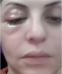 .رائع فينكم من زمان ولماذا لا تعلنون عن هذه الخدمة فكل اللذين عملوا بالدول العربية. Ù…ÙŠØ§Ø± Ø§Ù„Ø¨Ø¨Ù„Ø§ÙˆÙŠ Ø¨Ø¹ÙŠÙ† Ù…ØªÙˆØ±Ù…Ø© Ø´Ø§Ù‡Ø¯