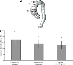 Circulatory system diagrams are visual representations of the circulatory system, also referred to as the cardiovascular common circulatory system diagrams show pulmonary circulation, coronary circulation, systematic circulation, veins, arteries, or a combination. A The Three Measured Aortic Levels With A Central Lumen Line Level A Download Scientific Diagram
