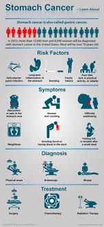 Learn what signs & symptoms of stomach cancer to watch out for such as a poor appetite, weight loss, belly pain, or heartburn. Stomach Cancer Signs Of Stomach Cancer Kimaja Farwani