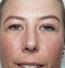 Fernie Skin and Beauty