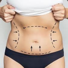 Body Jet Liposuction Dubai | Minimal Invasive Fat Removal