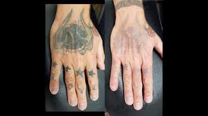 It's unlikely that your tattoo will be completely removed. The Best Way To Remove Permanent Tattoo At Home Permanent Tattoo Tattoo Removal Laser Tattoo Removal