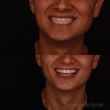 Mauro Castaño (@maoperfectsmile) · Instagram 照片和Reels