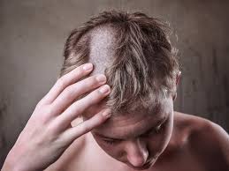 In one variety, the hair is cut off at about jaw length all the way around. Haircut Horror Stories That Will Make Your Cringe