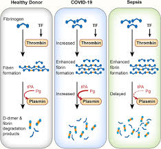 It was first identified in december 2019 in wuhan,. Covid 19 And Sepsis Are Associated With Different Abnormalities In Plasma Procoagulant And Fibrinolytic Activity Arteriosclerosis Thrombosis And Vascular Biology