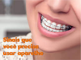 4 Sinais De Que Voce Precisa Usar Aparelho