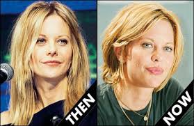 The general consensus was that yes, meg ryan did have plastic surgery during her time away from the public. Meg Ryan Plastic Surgery Plastic Surgery Stars