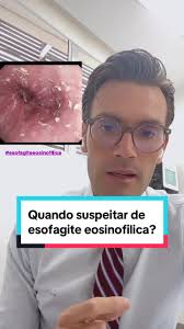 Diagnóstico e Tratamento da Esofagite Eosinofílica pelo Dr. Nelson Cathcart  Jr