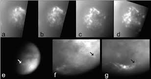 The methane cloud registered on the radars of kayrros sas final month. Tropospheric Cloud Features On Titan A D A Sequence Of Four Download Scientific Diagram